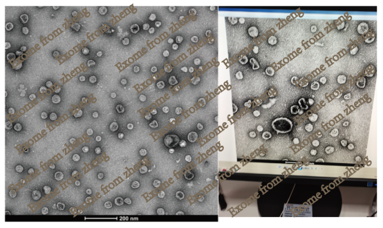 外泌体表征电镜测定.png 外泌体表征电镜测定.png